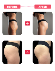 Booty Max® – Lift, Plump & Firm Buttock Cream with Volufiline 8%