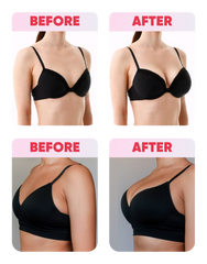 Breast Max® – Lift, Firm & Volumize Breast Cream with Volufiline 5%